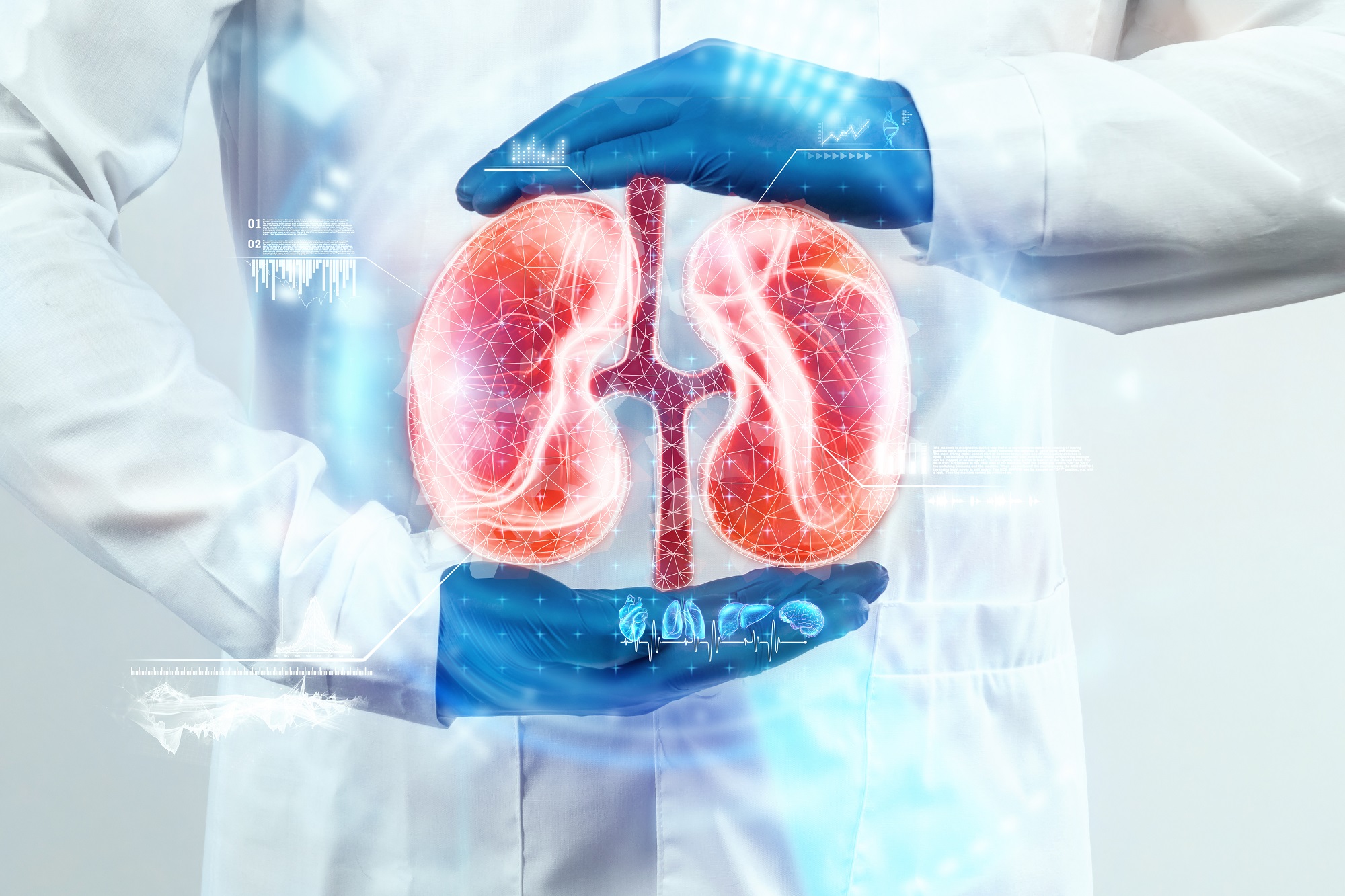 Cirurgia de Transplante Renal em Salvador - Dr. Davi Seixas