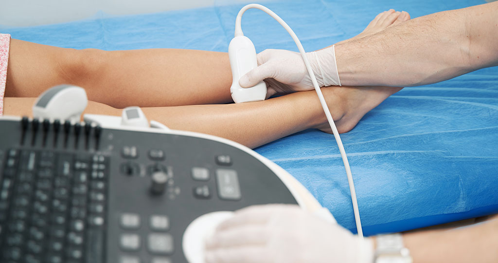 O que é o Doppler Vascular e por que ele é essencial O que é o Doppler Vascular e por que ele é essencial