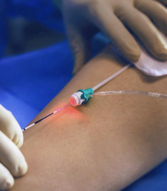 https://daviseixasvascular.com.br/wp-content/uploads/2026/03/endolaser-salvador.jpg